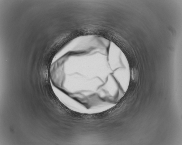 X0000111501155200908111240