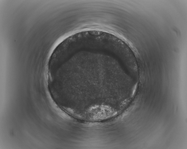 X0000111501522200908111235