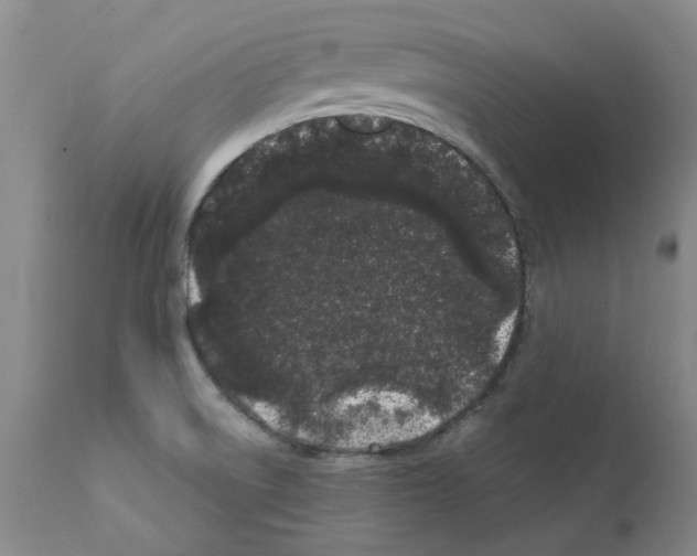 X0000111501522200908251037