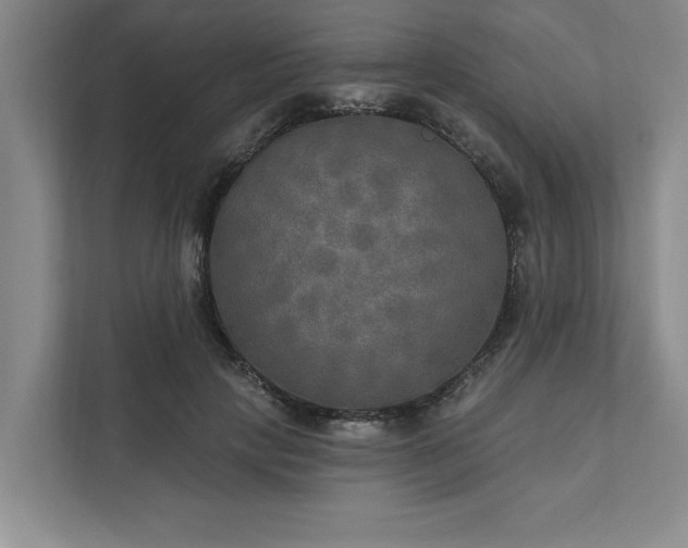 X0000111510649200907211204