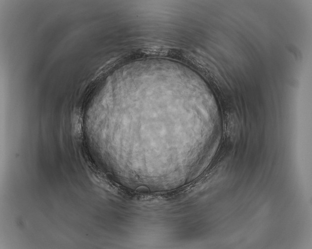 X0000111511154200908041216