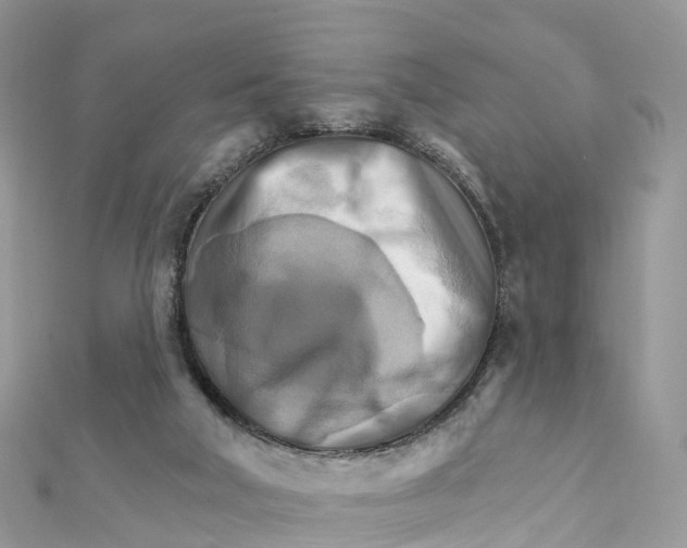 X0000111510018200908111319