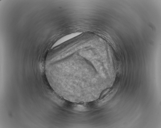X0000111510285200908111315