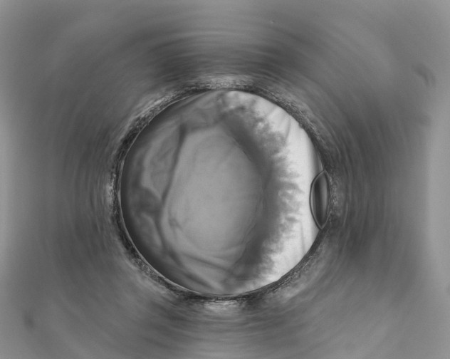 X0000111510357200908111314