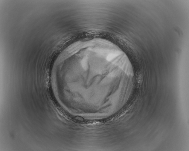 X0000111510868200908111307