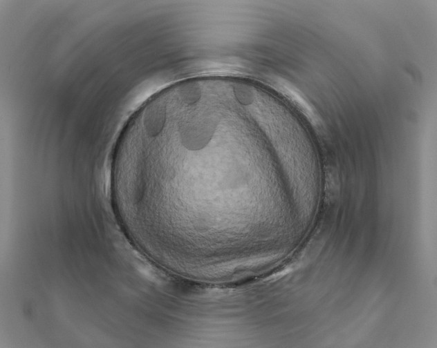 X0000111511419200908111259