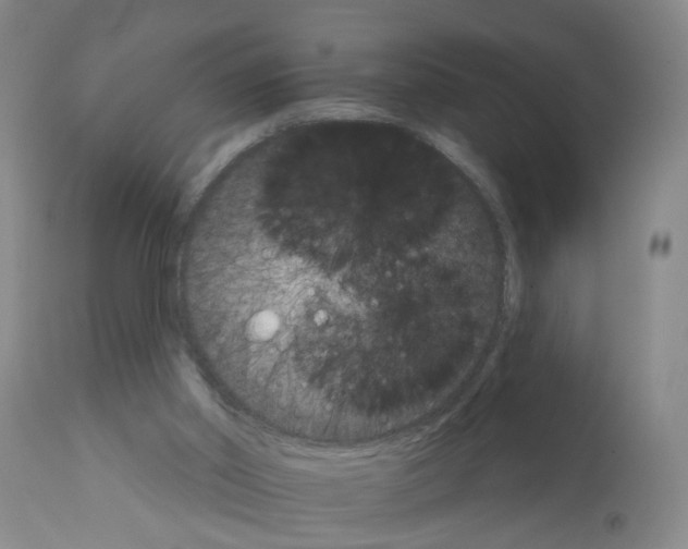 X0000111510014200908251124