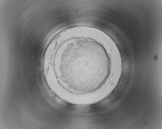 X0000111510856200908251111