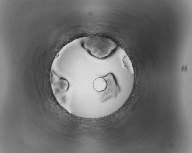 X0000111511153200908251106