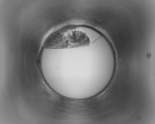 X0000111511175200908251106