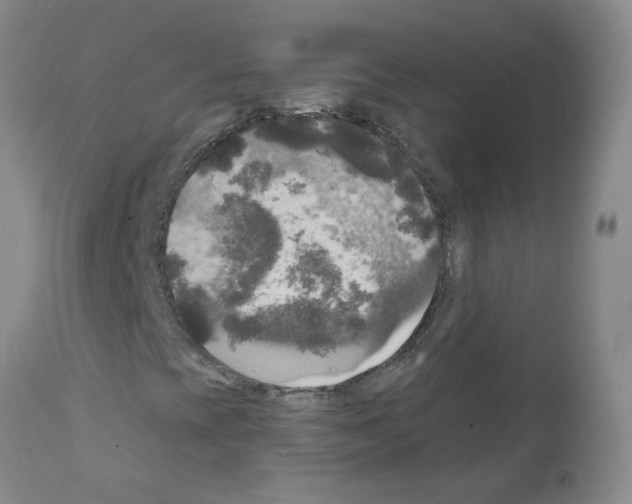 X0000111511393200908251102