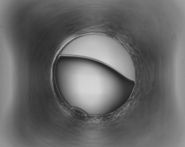X0000111520148200907141243