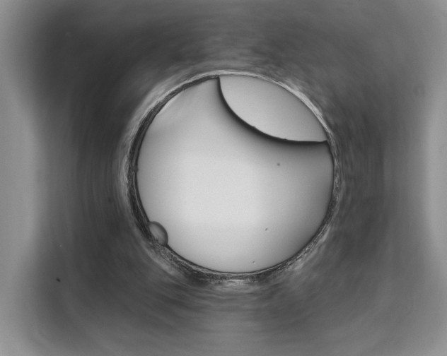 X0000111520151200907141243