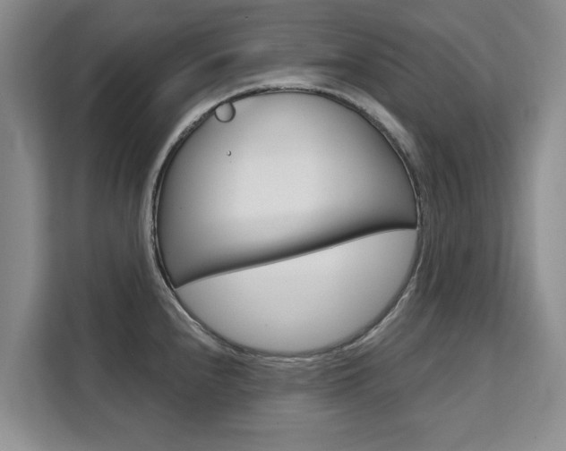 X0000111521240200907141230