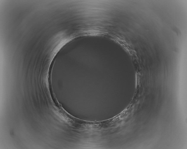 X0000111520147200907141515