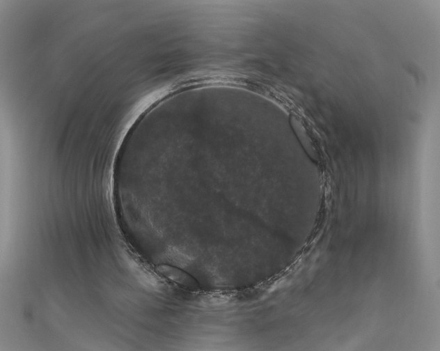 X0000111520148200907141515