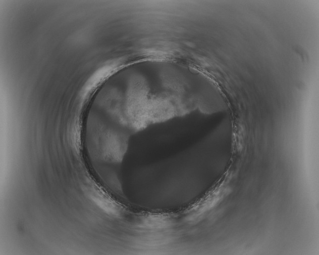 X0000111520149200907141515