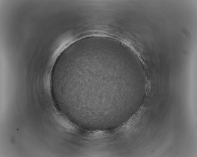 X0000111520151200907141515
