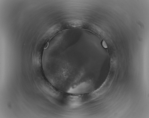 X0000111520170200907141515