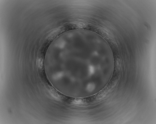 X0000111520177200907141515