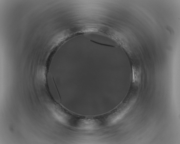 X0000111520300200907141513