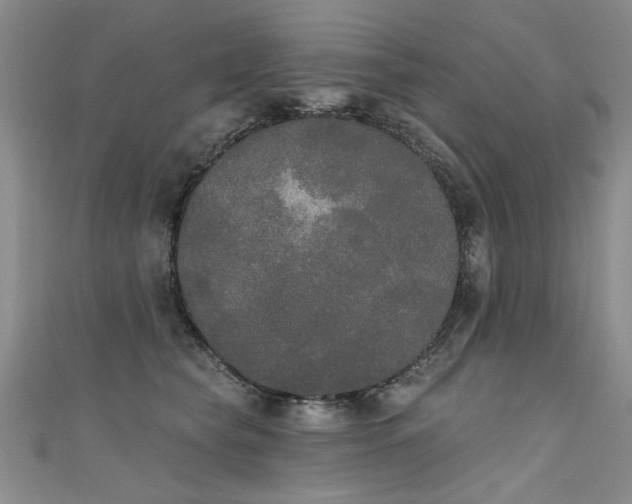 X0000111520565200907141510