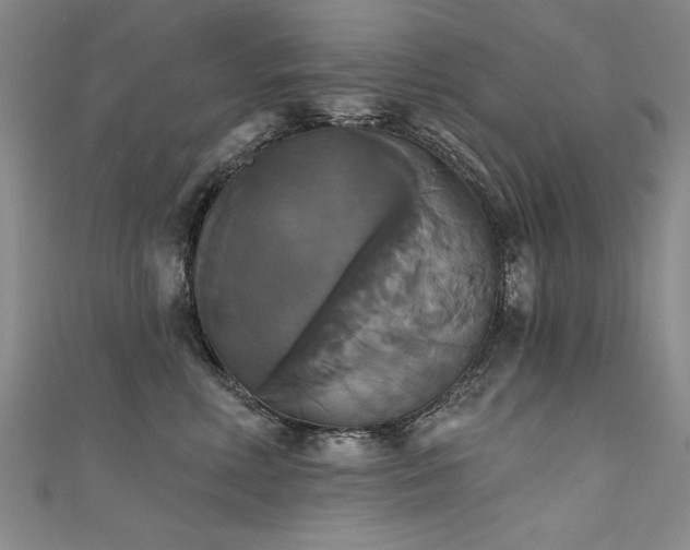X0000111520618200907141509