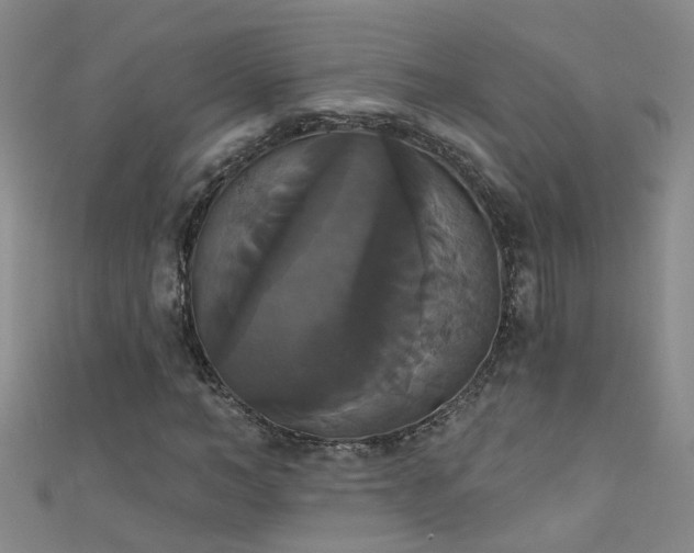 X0000111520966200907141504