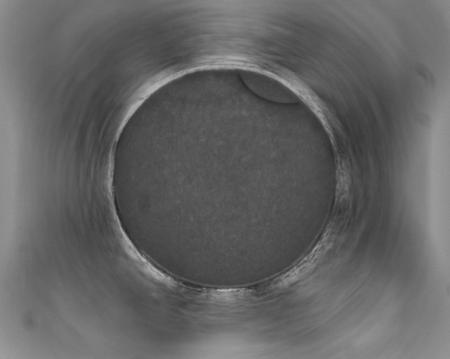 X0000111521390200907141459