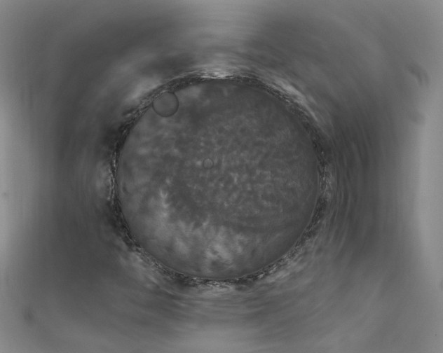 X0000111521446200907141458