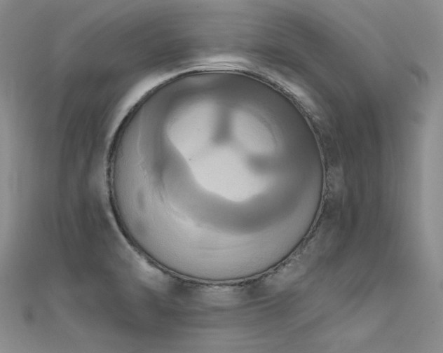 X0000111521470200907141458