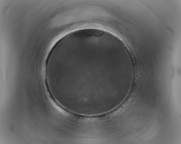 X0000111521519200907141457