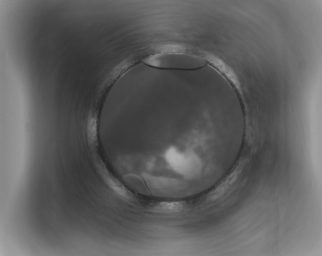 X0000111520057200907211232