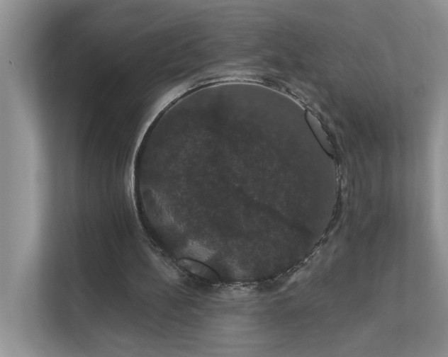 X0000111520148200907211231