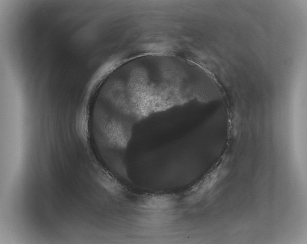 X0000111520149200907211231