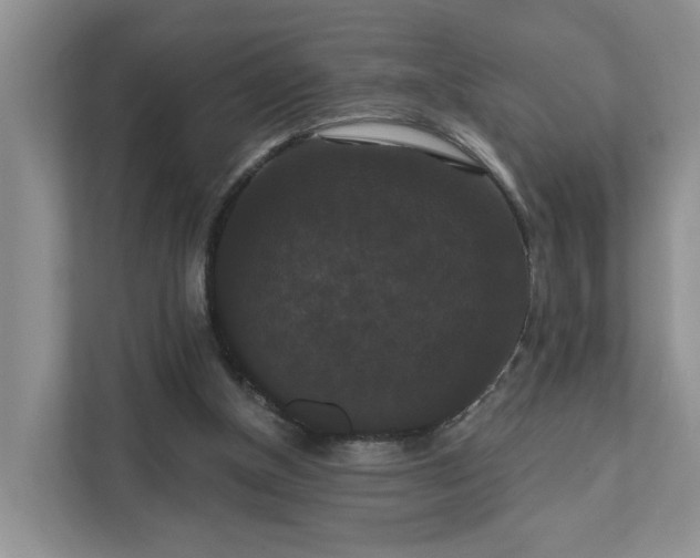 X0000111520154200907211231