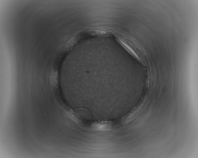 X0000111520563200907211226