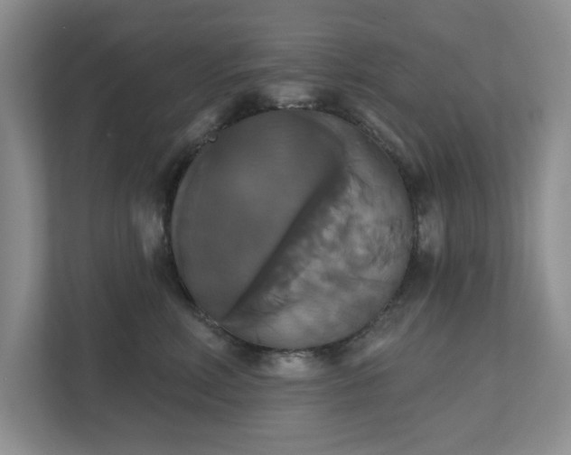 X0000111520618200907211225