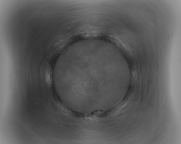 X0000111521250200907211217