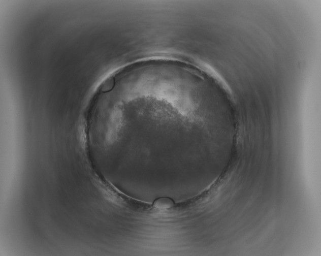 X0000111521360200907211215