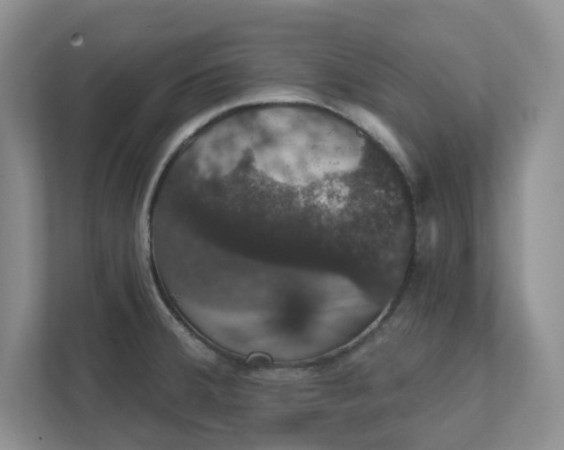X0000111521380200907211215