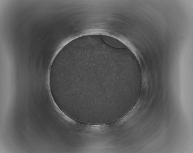 X0000111521390200907211215