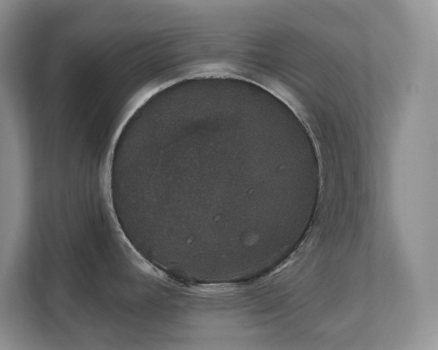 X0000111521392200907211215