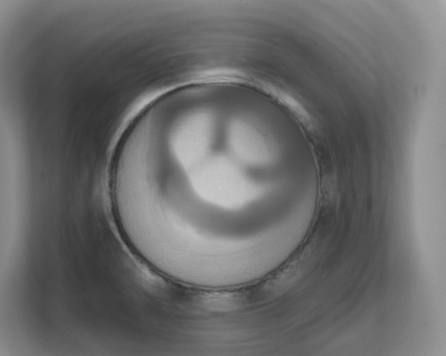 X0000111521470200907211214