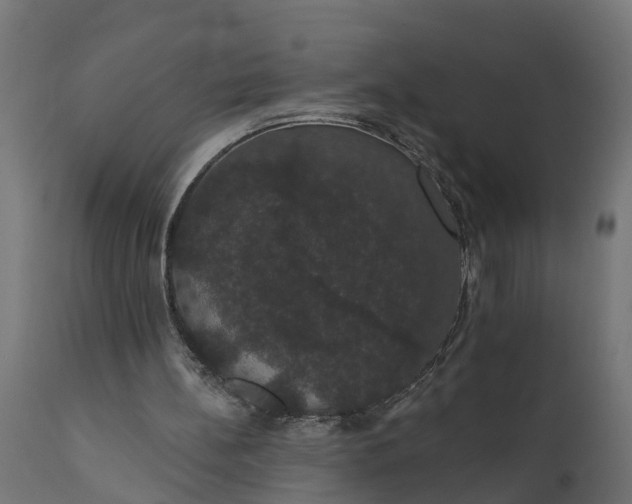 X0000111520148200907281347