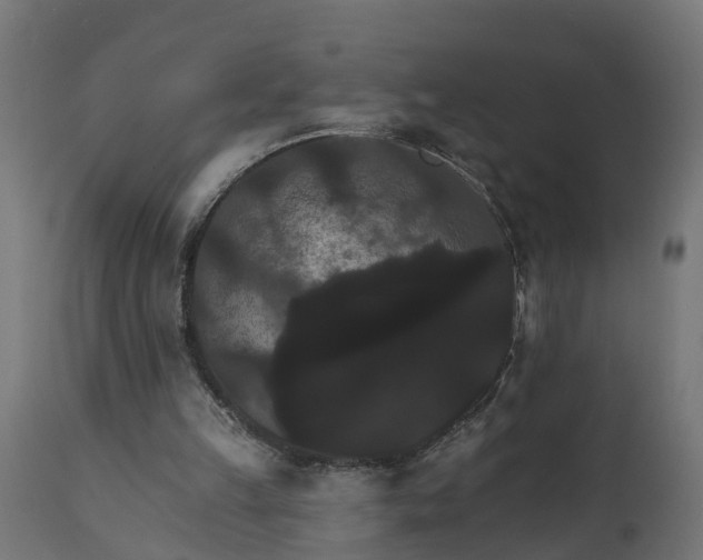 X0000111520149200907281347