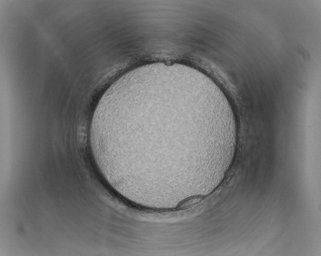 X0000111520017200908041253