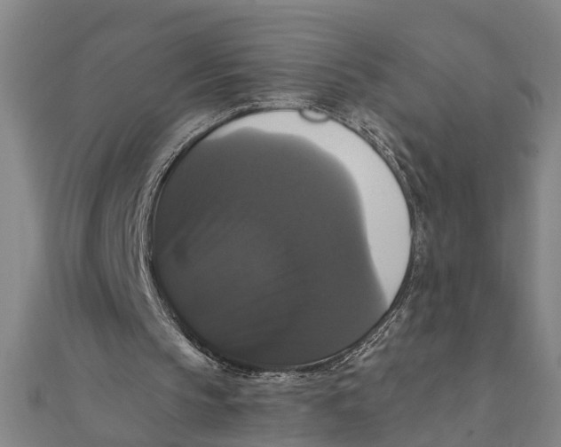 X0000111520145200908041251