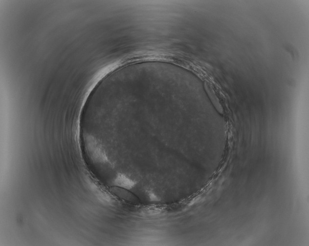 X0000111520148200908041251