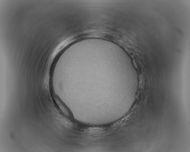 X0000111520150200908041251